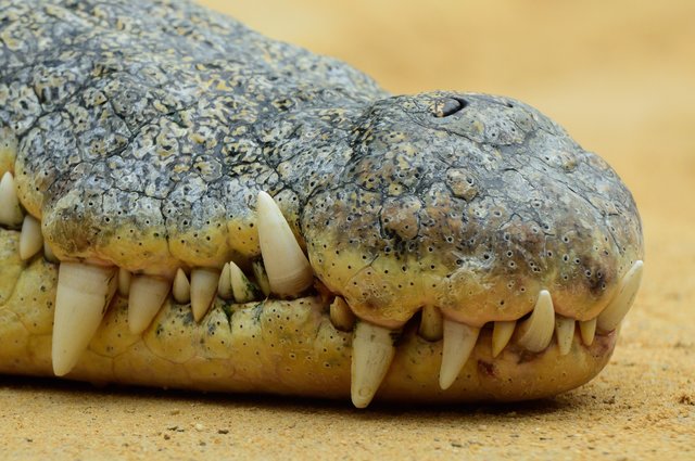 Zahnarzt's Alptraum  :-)