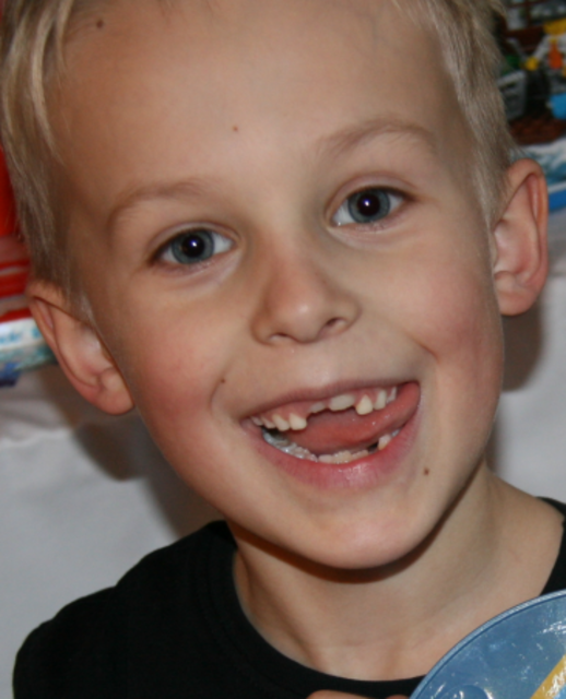 Guck mal, ich kann  den schon  mit der Zunge wackeln