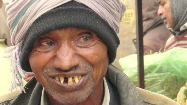 keine perfekten zähne und trotzdem ein lächeln. dieser inder ist arm und kann sich keinen zahnarzt leisten...