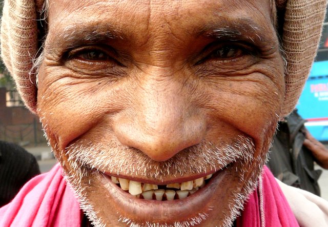 ein perfektes lächeln mit nicht perfekten zähnen...