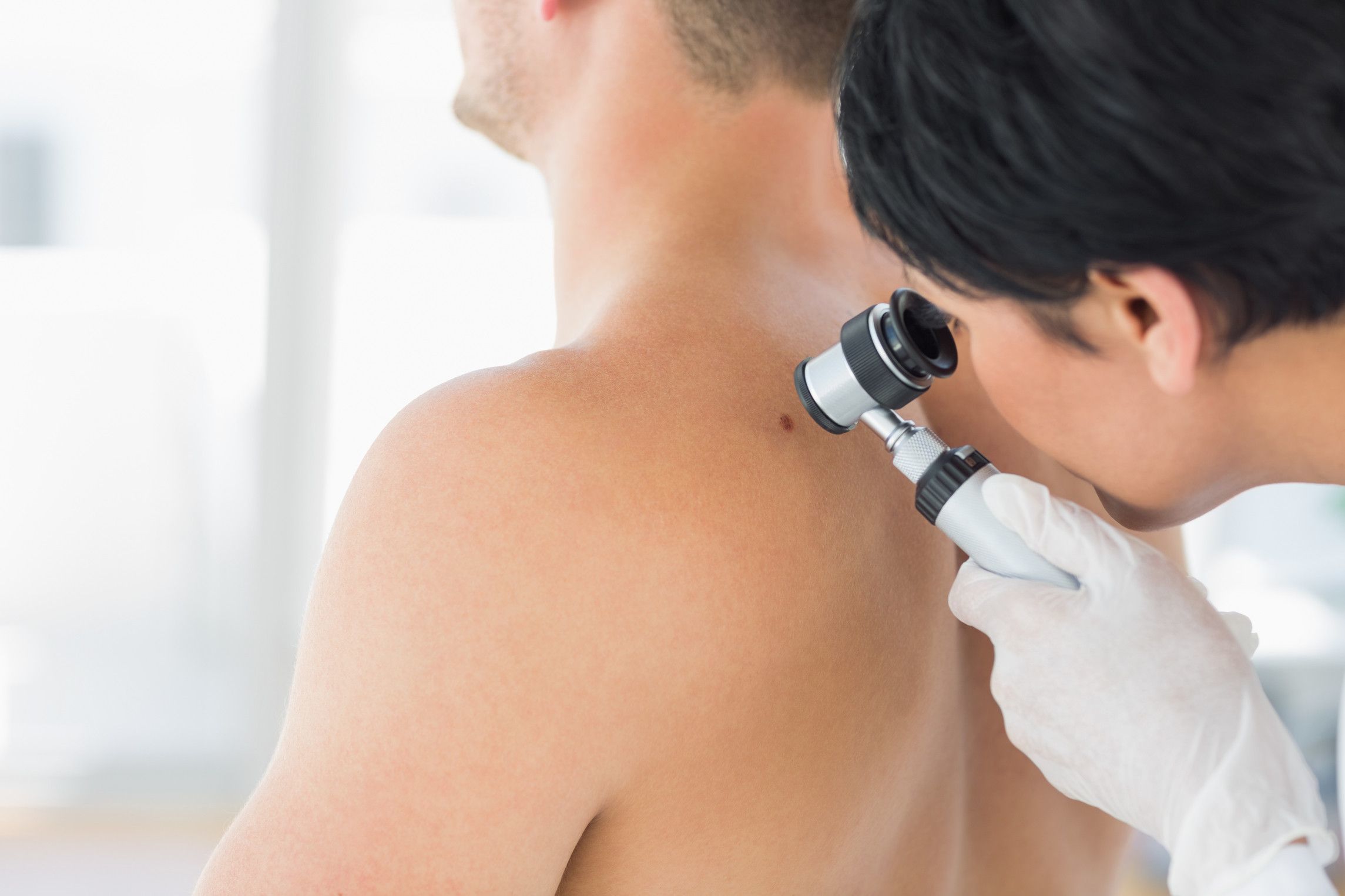 Durch das Hautkrebs-Screening ist es möglich, bereits Frühstadien von Hautkrebs zu erkennen. Doch das kostenfreie Screening der gesetzlichen Krankenkassen wird nur wenig genutzt.