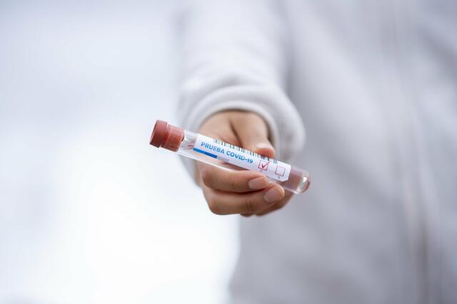 Der negative Test kann – je nach Zeitpunkt – auch nur bedeuten, dass die Virenlast im Körper für einen Nachweis noch nicht hoch genug ist, obwohl eine Infektion besteht.
