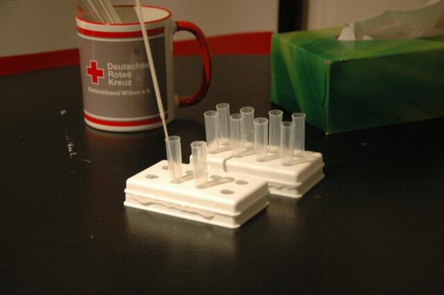 Der Abstrich wird mit einer Flüssigkeit vermengt - diese wird dann auf dem Teststreifen getropft. | Foto: Nicole Martin