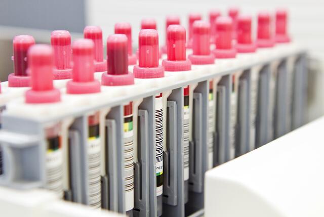 130 Neuinfektionen mit dem Coronavirus wurden dem Kreisgesundheitsamt innerhalb eines Tages gemeldet.