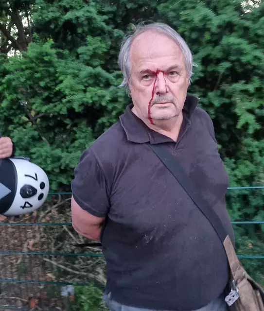 Rechtsanwalt Roland Meister blutend und in Handschellen | Foto: B. Urbat