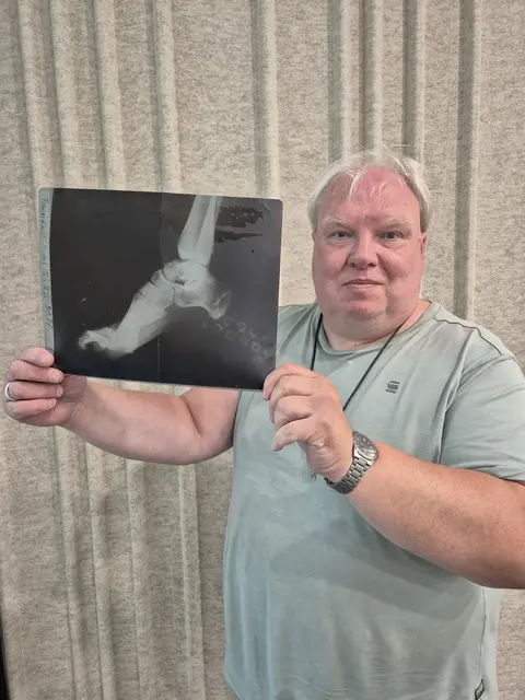 Thomas Frauendienst mit dem verhängnisvollen Röntgenbild: Weil er mit "Klumpfüßen" geboren wurde, gaben seine Eltern ihn in die "Krüppelanstalt" nach Volmarstein, wo er Unfassbares erlebte. 
 | Foto: Dabitsch