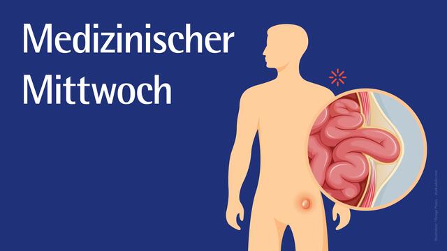 Infoveranstaltung zum Thema Hernien: St. Josef-Krankenhaus Kupferdreh | Foto: Illustration: ©Design Praxis - stock.adobe.com